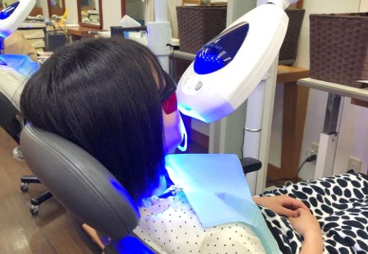 セルフホワイトニング